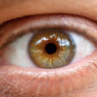 Les yeux d'une femme atteinte de glaucome que le complément alimentaire GCAO permet de traiter naturellement