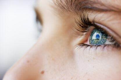 Les yeux d'une femme atteinte de tension oculaire que le complément alimentaire Forskoline permet de traiter naturellement
