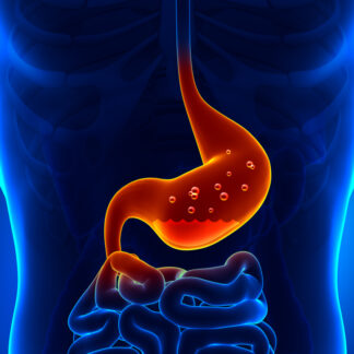 Estomac atteint d'acidité gastrique que le complément alimenatire Digestconfort permet de traiter naturellement